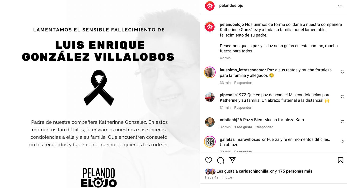 Pelando el ojo se solidarizó con Katherinne González por el devastador momento que vive la imitadora, el cual comunicó este miércoles a través de sus redes sociales.