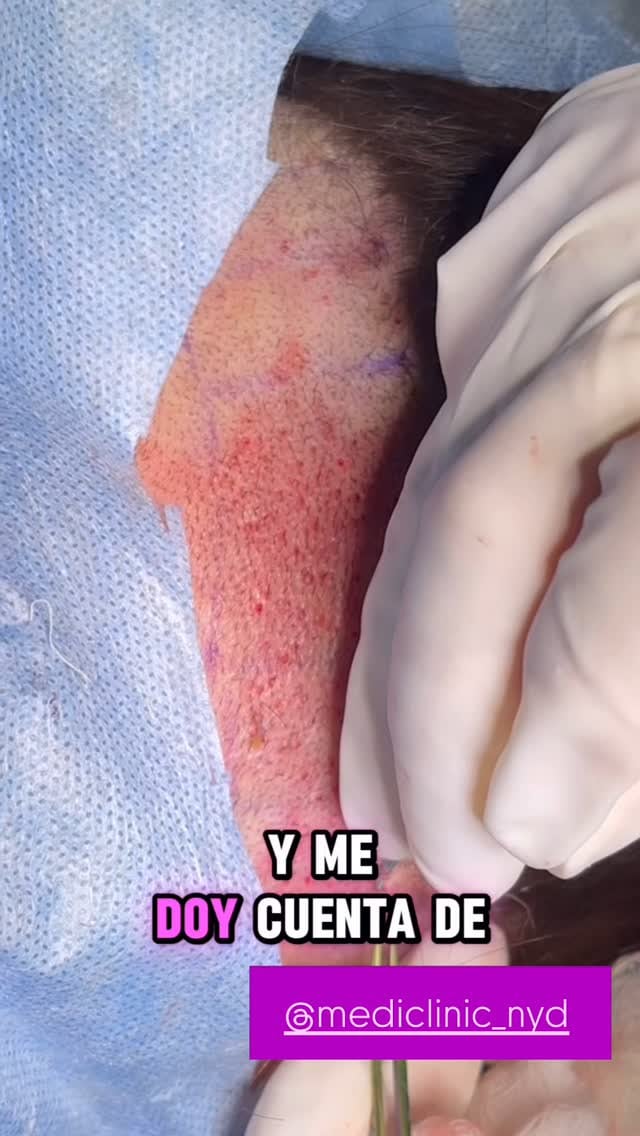 Marilin Gamboa está fascinada con lo que se hizo para verse más guapa.