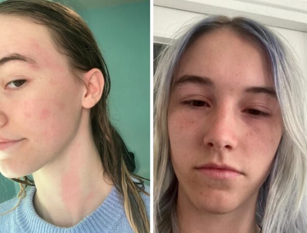 Chloe Ramsay. Foto: El Tiempo