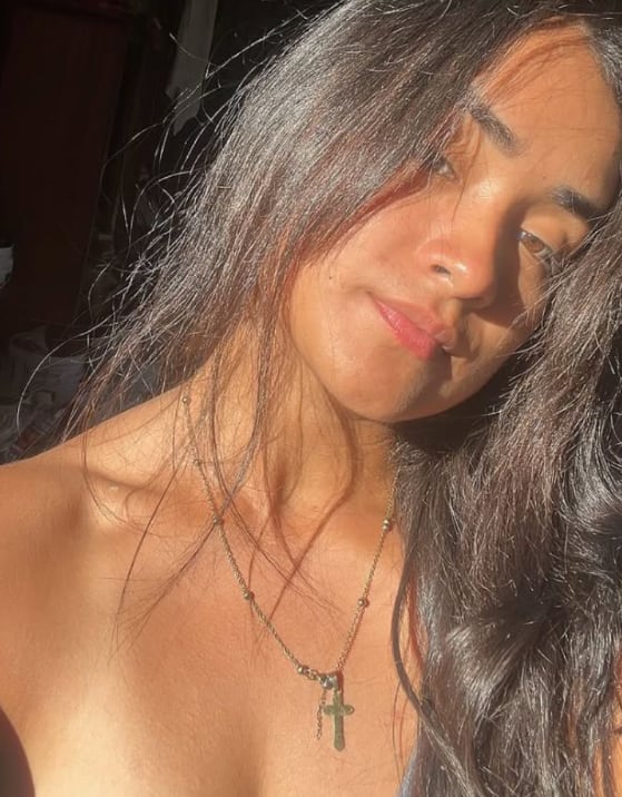 Elizabeth fue embestida por uno de los carros cuando se dirigía en moto hacia su casa. Foto cortesía.
