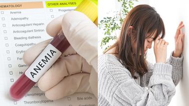 ¿Cómo saber si tengo anemia?