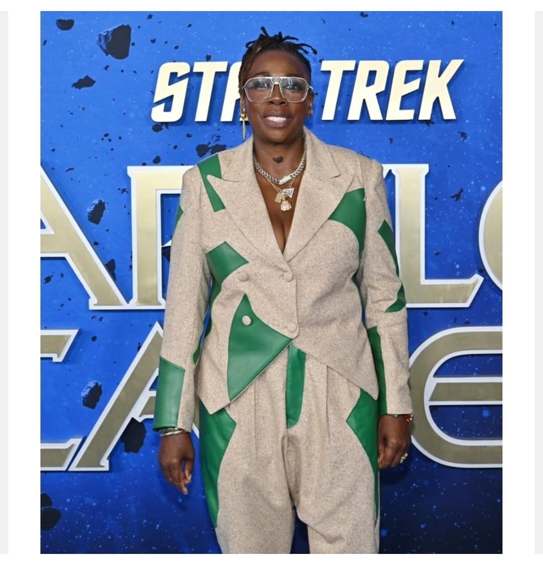 La actriz Gina Yashere llegó a Costa Rica por un tratamiento dental.