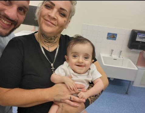 Natarlia Nappi, bebé con rara enfermedad. Foto: Facebook