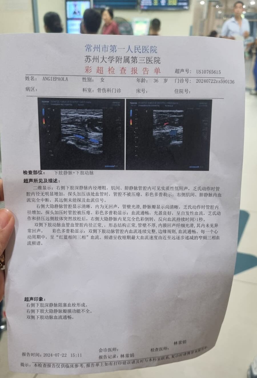 Angie Morales viajó a China por una beca y terminó en el hospital con una trombosis