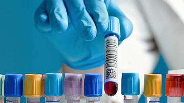 Hallaron bacterias vampíricas mortales y los científicos están preocupados