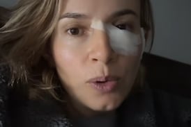 Pensó que era un lunar y terminó siendo cáncer de piel