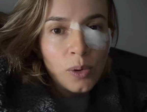 La mancha en el párpado fue diagnosticada como cáncer de piel tras una biopsia.