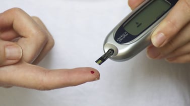 CCSS lanza estrategia dental para pacientes con diabetes y presión alta en 15 áreas de salud