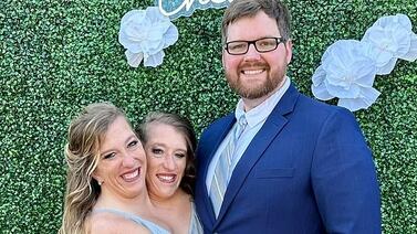 Siamesas Abby y Brittany Hensel: ¿cómo es su vida íntima ahora que una está casada?