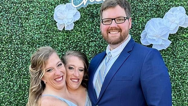 Una de las gemelas siamesas más famosas del mundo, Abby Hensel, ya está felizmente casada, mientras su hermana, Brittany, con quien comparte el mismo cuerpo, esta solterita y sin compromiso.