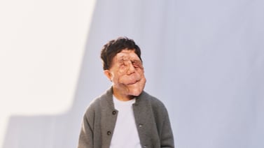 El actor Adam Pearson respondió así a comediante que hizo “chiste” con su apariencia