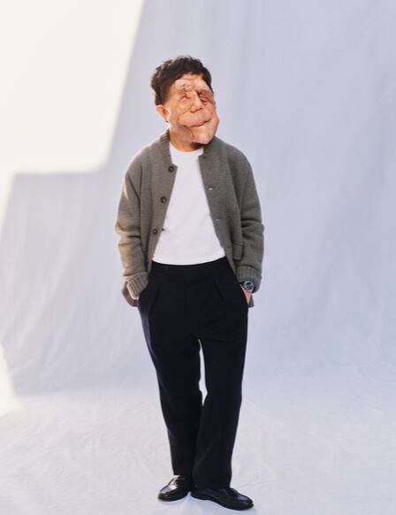 Adam Pearson le respondió al comediante.