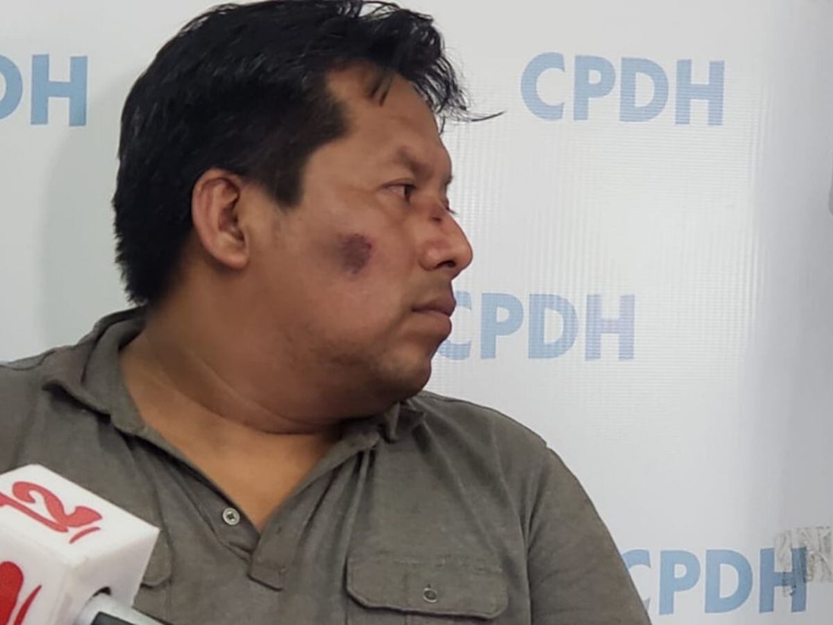 Los medios de comunicación de Nicaragua cubrieron el secuestro de Gabriel.