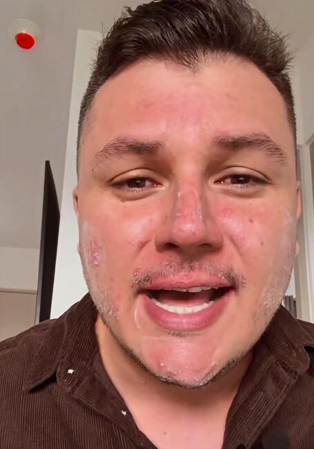 Josué Sánchez habló con el corazón hace unas semanas sobre la lucha que enfrenta y este martes mostró las secuelas que paga por eso