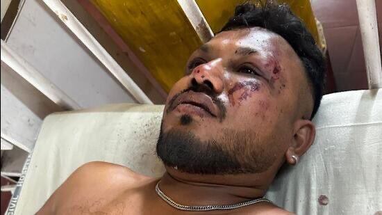 Ramesh Vishwashkumar, un ciudadano británico de 48 años que ocupaba el asiento 11A, sobrevivió al accidente aéreo en India.