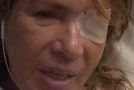 Yolanda Andrade tomó duras decisiones mientras lucha contra terrible enfermedad