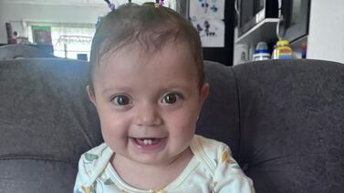 Bebita nació con la mitad del corazón, la otra parte la forman el amor y la fe de su familia