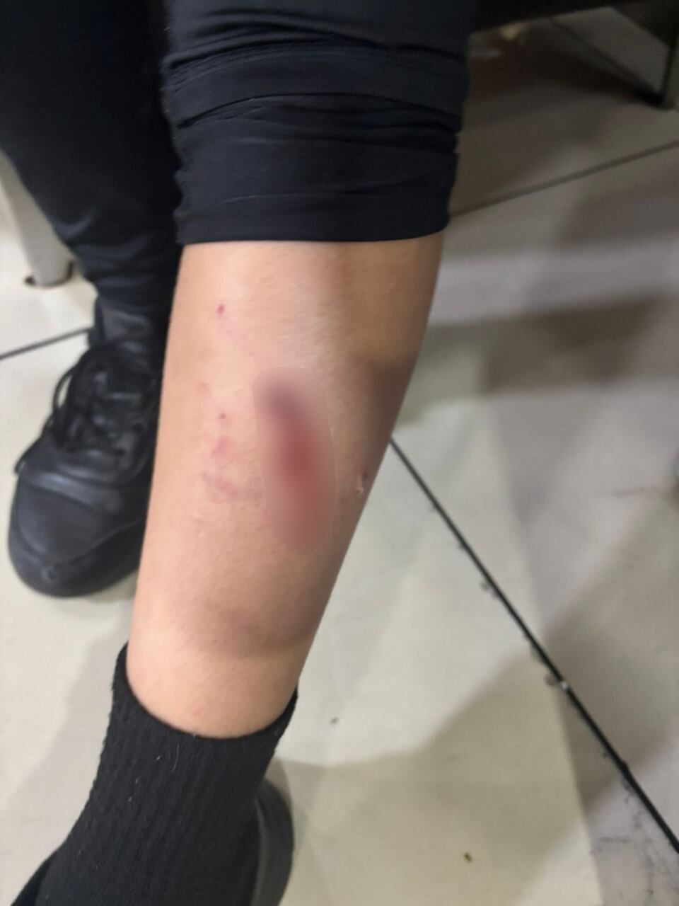 Imagen de identidad protegida de niño atacado por un perro en centro comercial