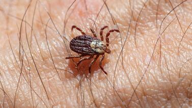 A Tiktoker tico se le murieron el papá y el abuelo en dos días por enfermedad de las garrapatas