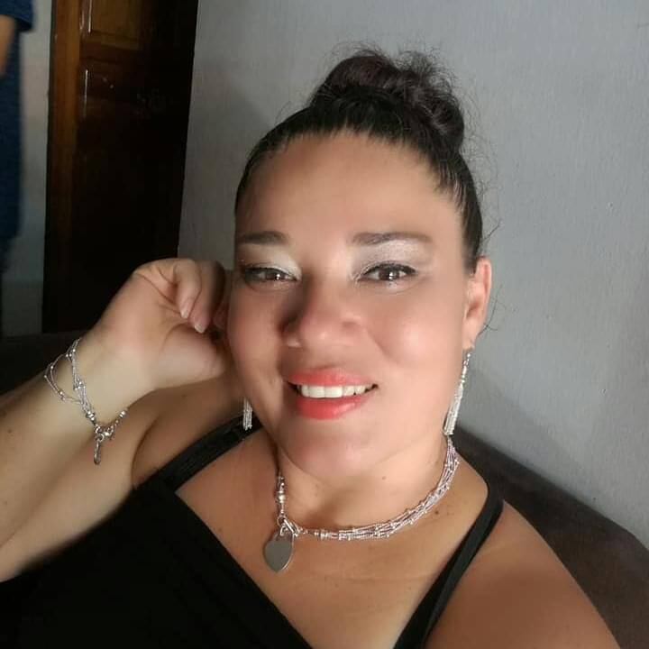 Annia Guido, mujer que sobrevivió a balacera dentro de supermercado en Alajuela. Foto cortesía.