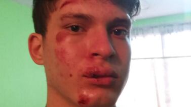 Joven que recibió golpe en la cabeza en las mascaradas estuvo inconciente y hasta convulsionó