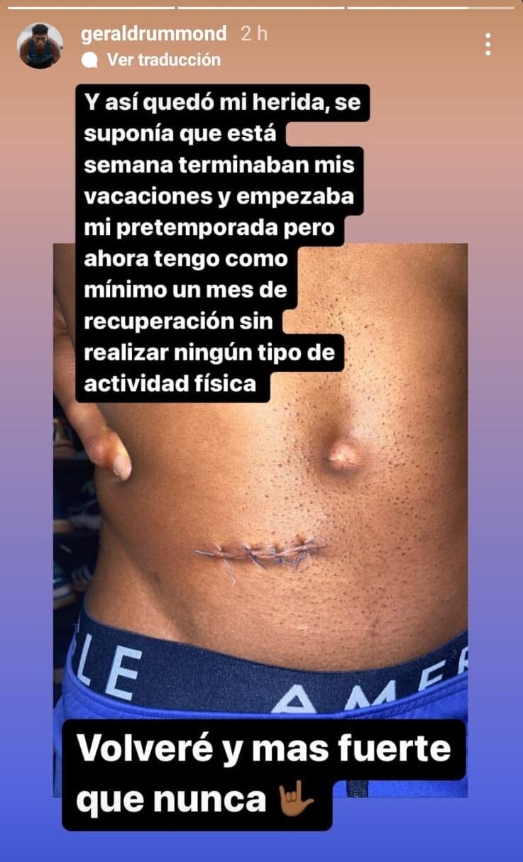 A Gerald Drummond le extrajeron el apéndice. Instagram.