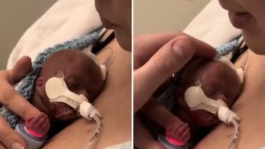Una mujer abraza a su bebé prematuro en un gesto de ‘despedida’, pero se sorprende por el resultado