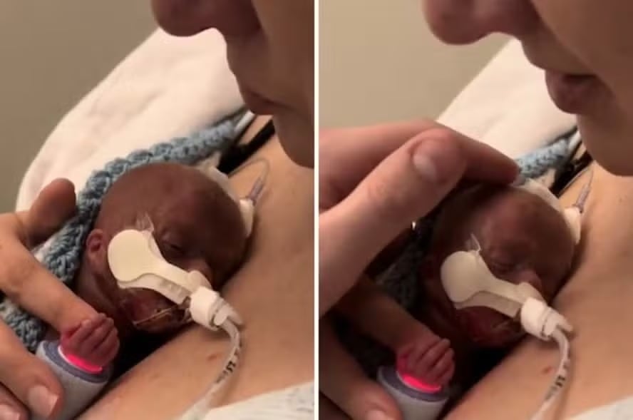 Sydney Files abraza a su bebé prematuro, Cooper, en lo que pensó sería una despedida.