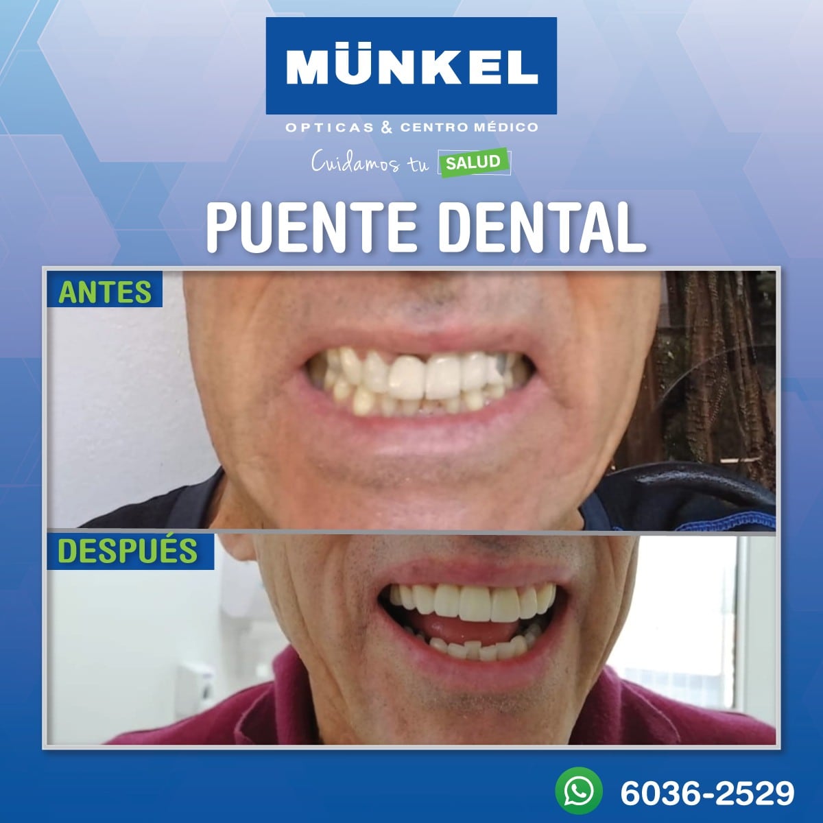 A partir de del próximo viernes 1 de setiembre arrancamos una nueva promoción: “Código Teja con Münkel”, la cual le regalará, de lunes a domingo, una tarjeta con 200 dólares (un poquito más de 105 mil colones), para que los aproveche en su salud o la de su familia.
