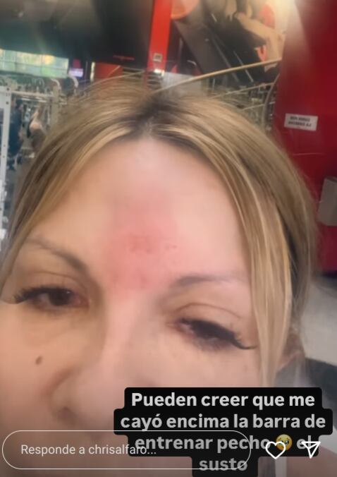 Cristiana Alfaro, esposa de Austin Berry, sufrió un accidente en el gimnasio.