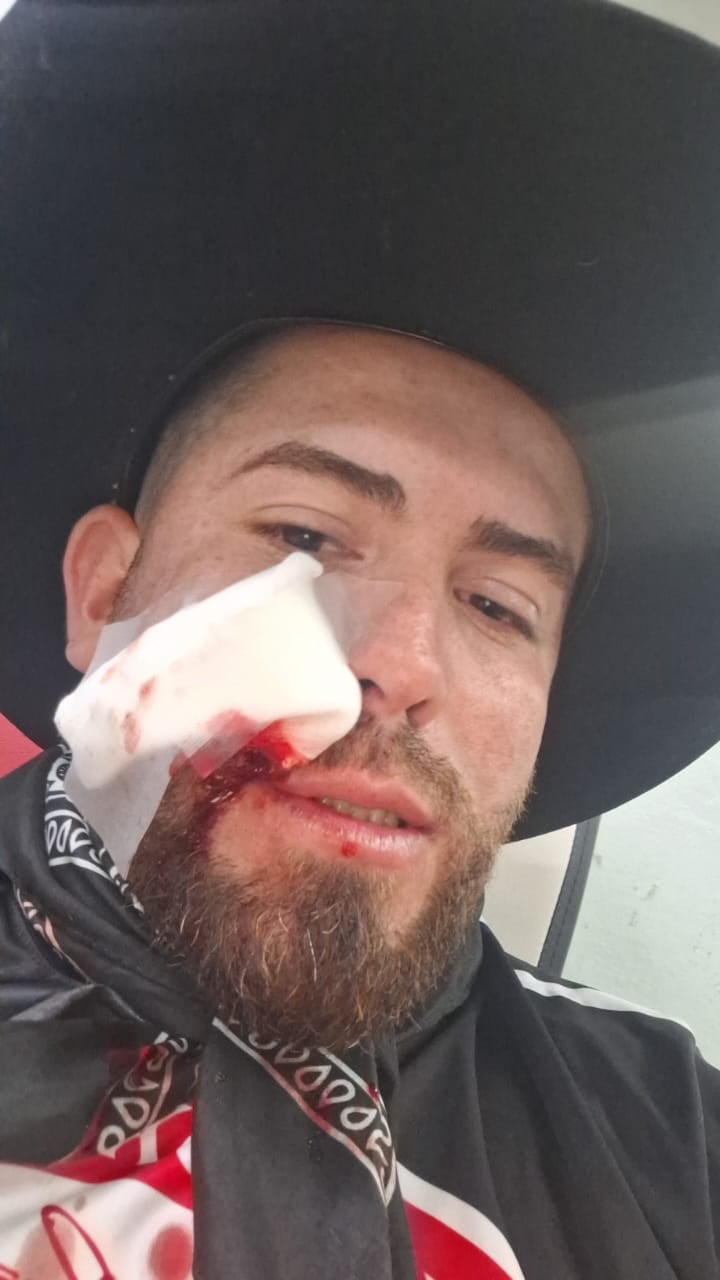 Michael Bleak pasó el fin de semana en boca de la gente por arriesgar su vida para salvar a un montador que quedó guindado del toro en el redondel de Palmares