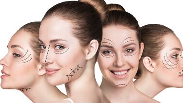 Muchacha se rellenó los labios con ácido hialurónico y resultado impactó a todos