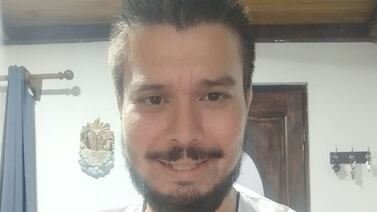 Locutor de La Caliente se abre la camisa y muestra la gran herida de su cirugía en el corazón