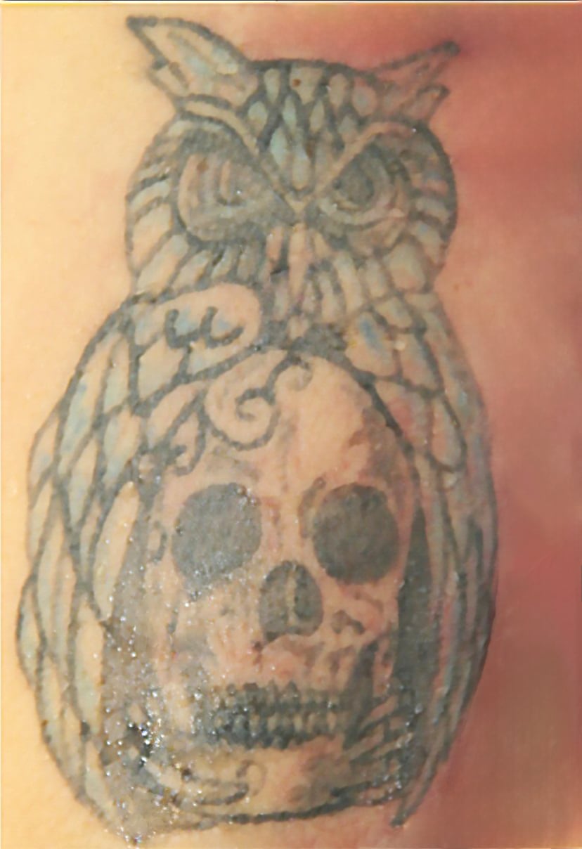 Tatuajes serían claves para identificar a mujer que falleció tras ser atropellada en Ipís.