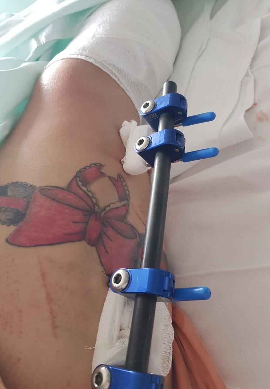 Maureen Montalbán, esteticista que sobrevivió a atropello de camión en San Carlos. Foto cortesía Maureen Montalbán.