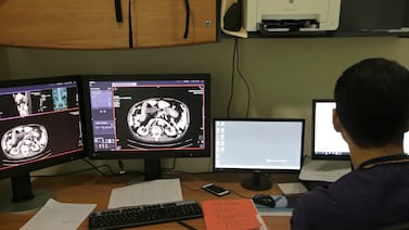 TAC del hospital de Heredia quedará fuera de servicio por 6 meses: ¿qué pasará con las citas programadas?