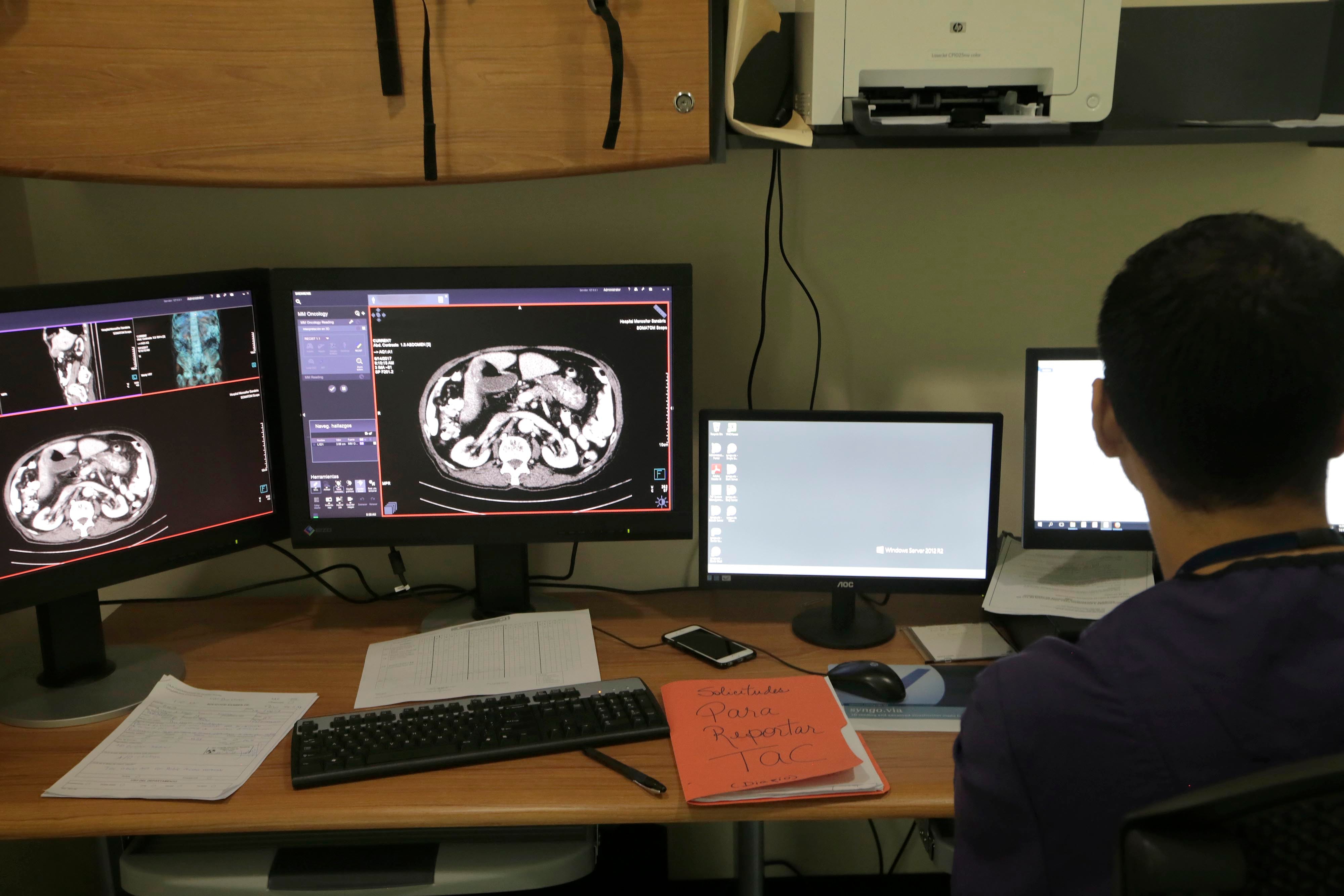 Varios monitores muestran imágenes médicas con fondo oscuro. A contraluz, el perfil de una persona de espaldas.