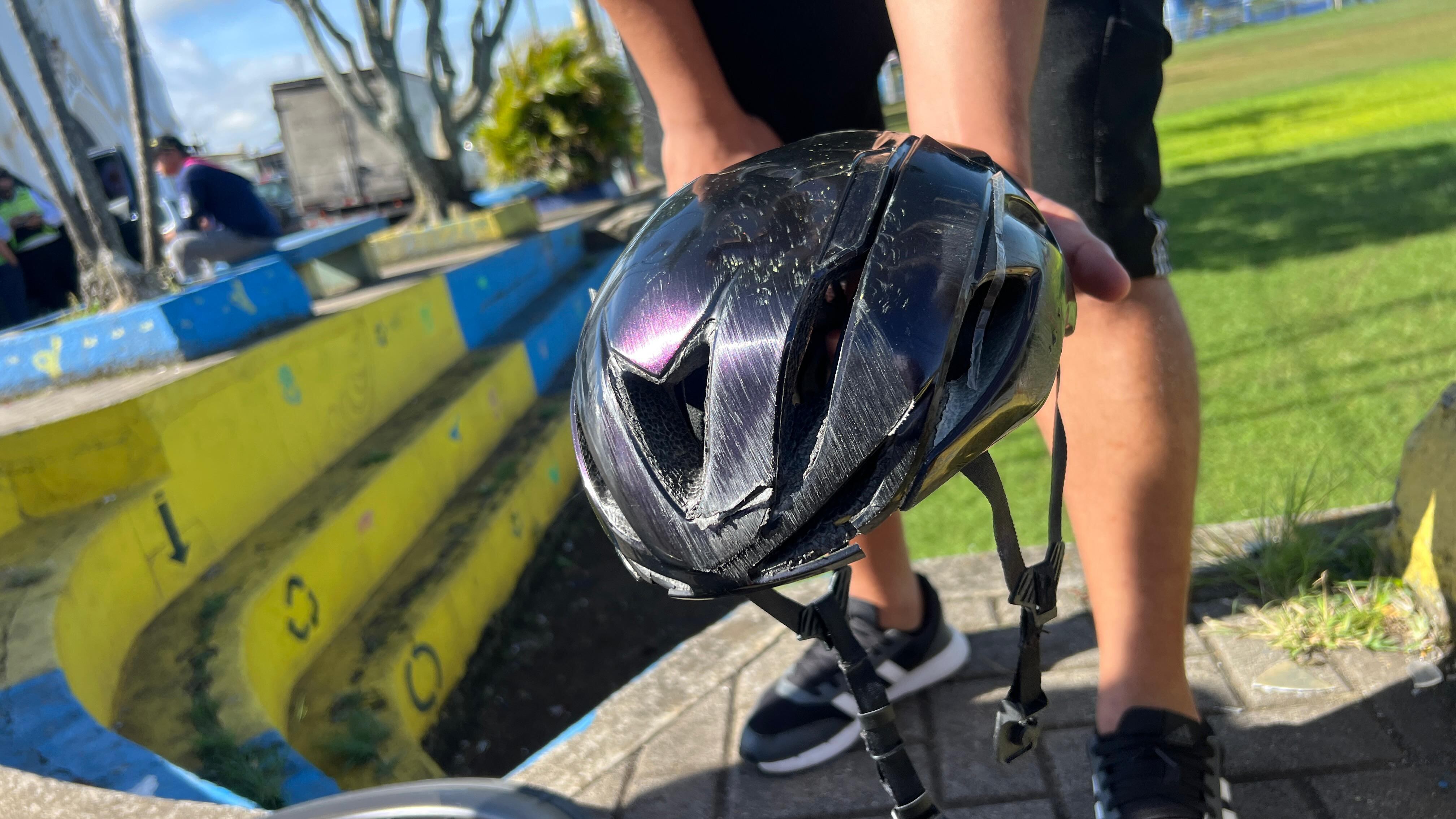 Juan Pablo Quirós Barquero, fue embestido por un carro debido a una imprudencia de un conductor. Foto cortesía Yohan Coto.