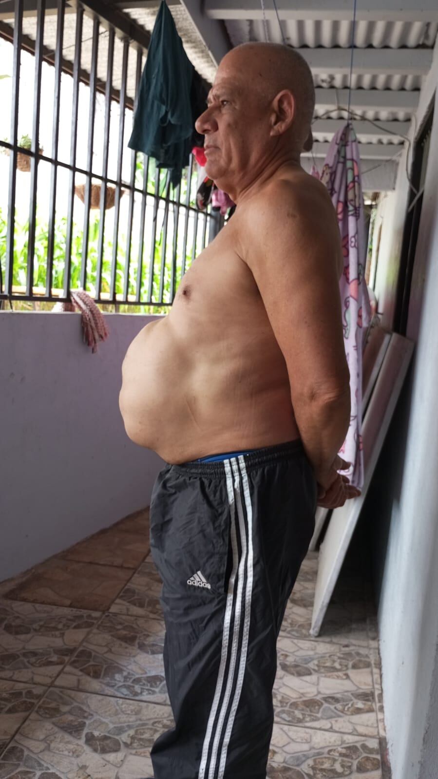 Omar Vindas tiene 8 años de esperar por una cirugía y considera que en la Caja no lo ayudan.