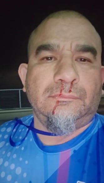 Seguidor de Rodrigo Chaves habría atacado a comunicador de radio Zurquí