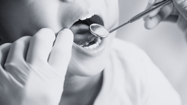 Niño fue llevado al dentista por unas caries y terminó con daño cerebral