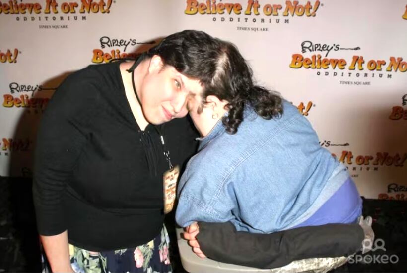 siameses más viejos del mundo