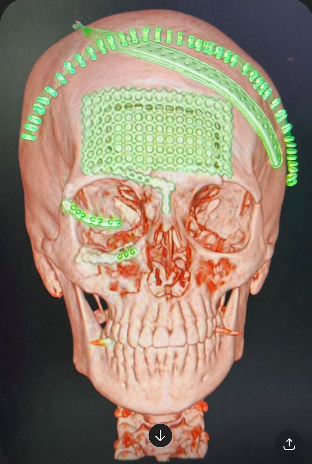 Natasha Alfaro ha encontrado la forma de salir adelante.