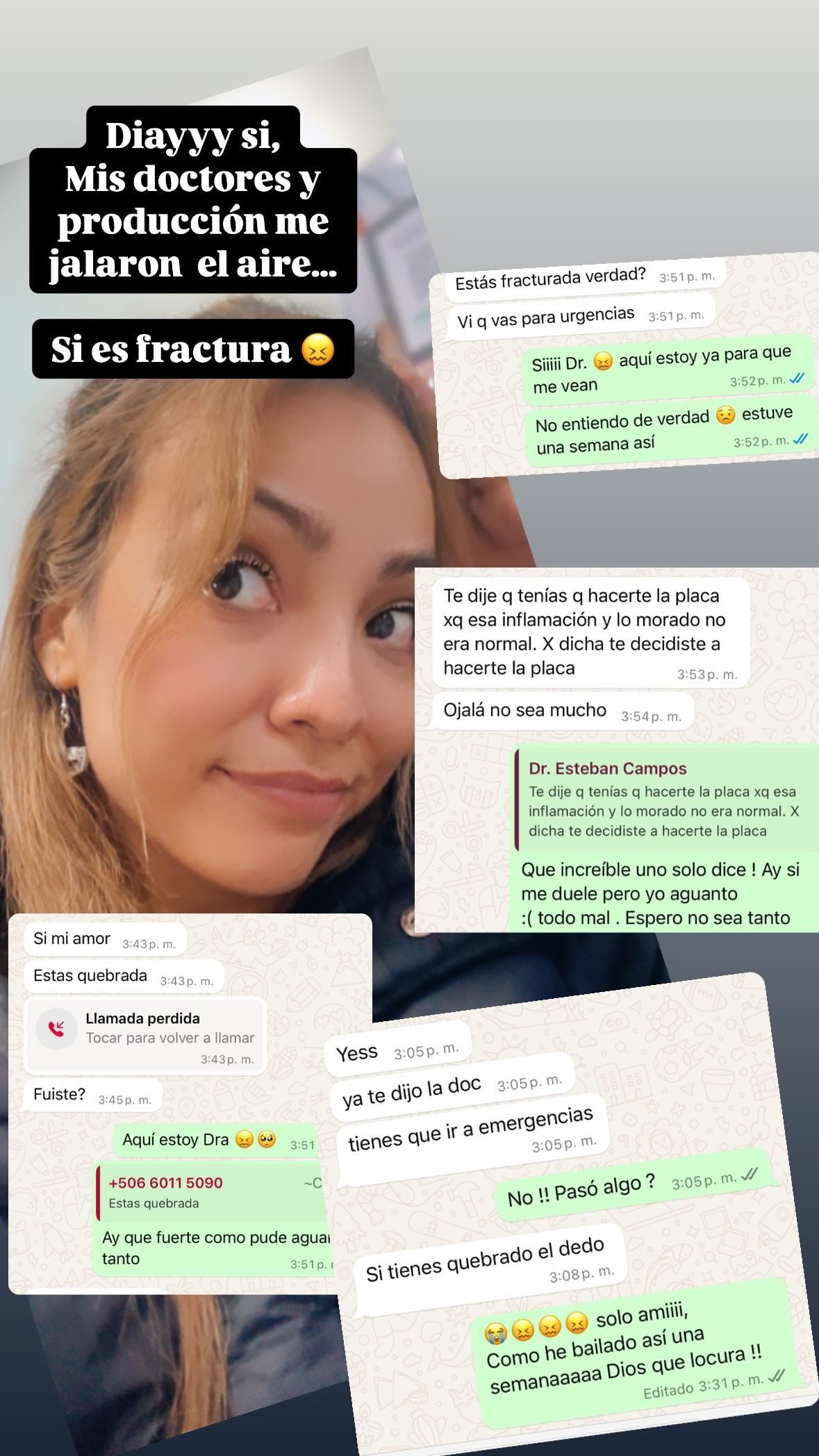Yessenia Reyes, pareja de Diego Bravo en Mira quién baila, se accidenta y tiene ruda lesión