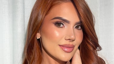 Joseline Valverde, esposa de Jonathan Moya, anda así tras su cirugía estética en la nariz