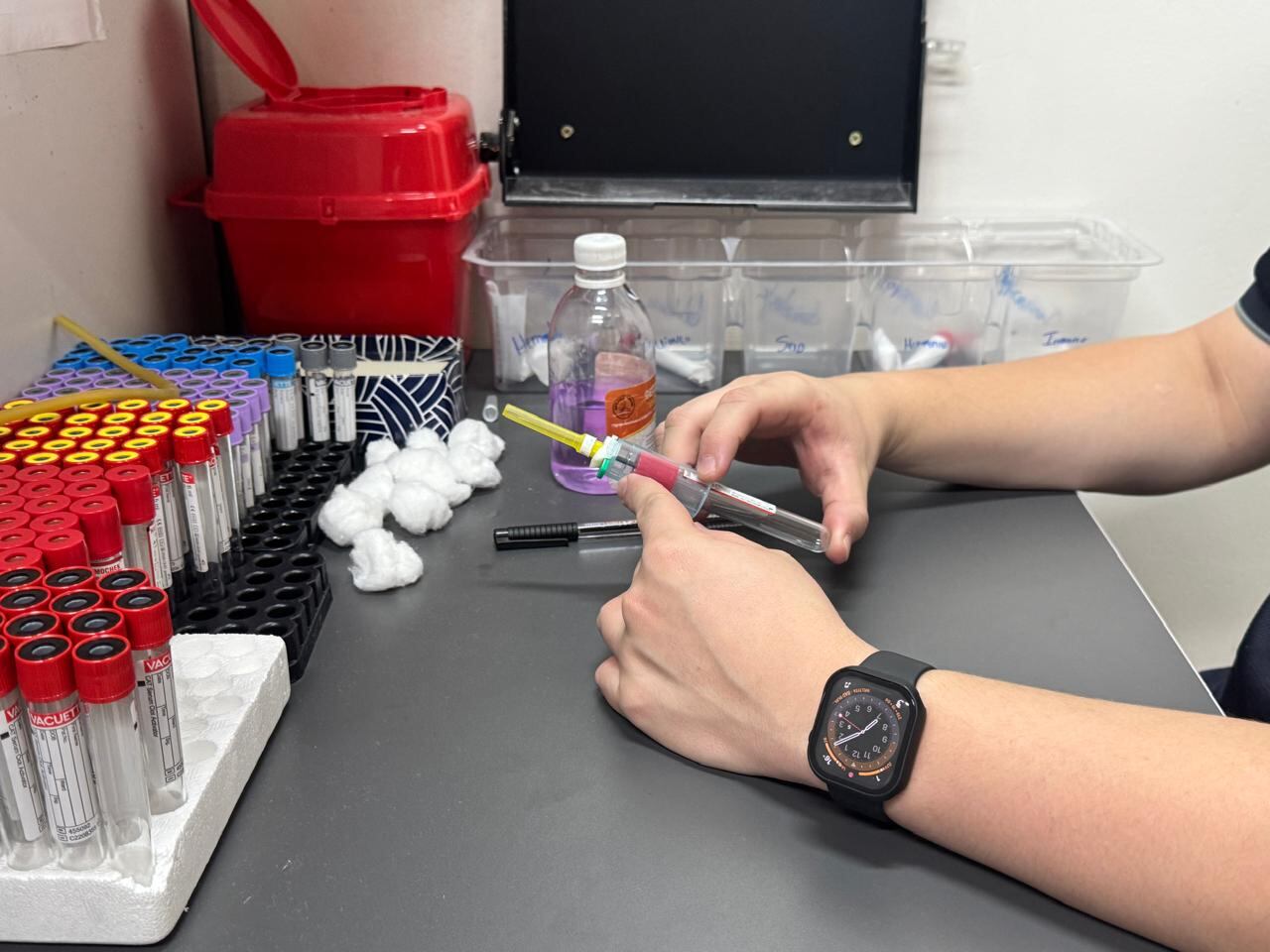 Una mano sostiene tubos con muestras de sangre para análisis.