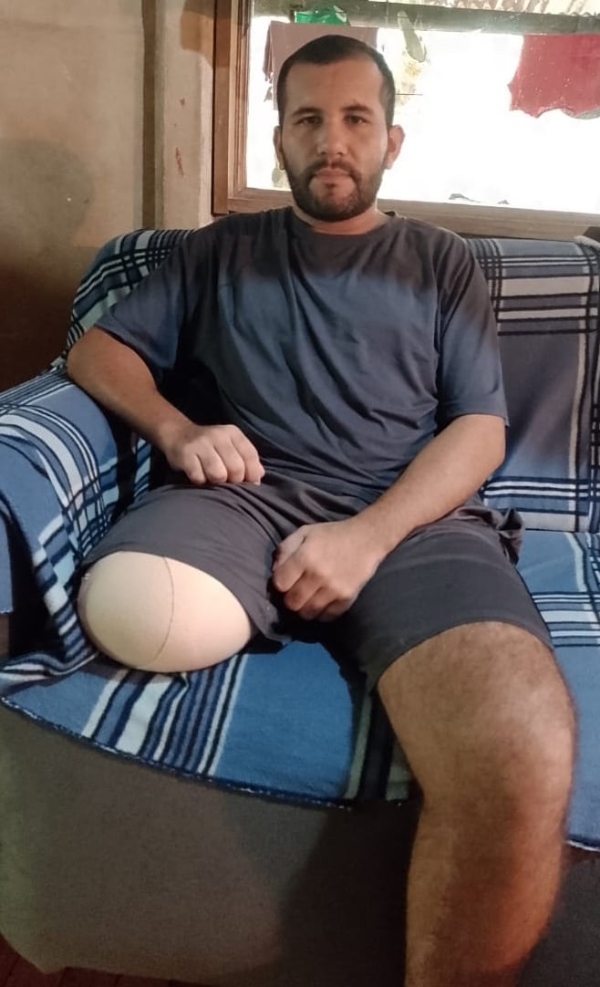 Martín Muñoz, joven que perdió pierna derecha en accidente de tránsito. Foto cortesía Martín Muñoz.