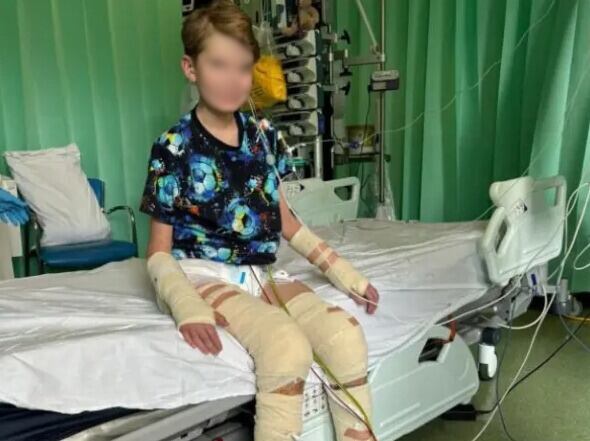 Austin, niño que perdió las piernas