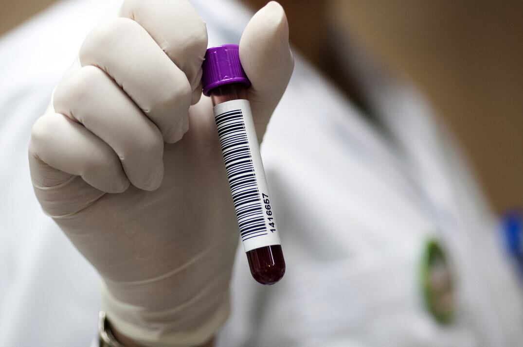 Un grupo de especialistas de la Universidad de Costa Rica (UCR) investigará los factores genéticos en Costa Rica que contribuyen a aumentar la severidad del covid-19 y describirá las secuelas prolongadas de esta enfermedad en la población costarricense