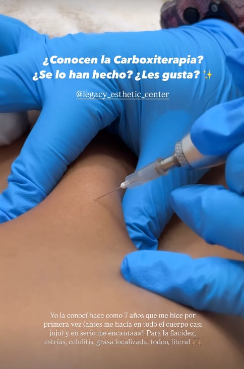 Paula Chavarría revela la situación que está sufriendo con su cara de un tiempo para acá